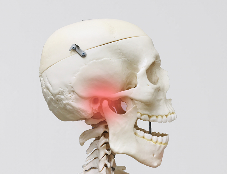 西馬込（大田区）の歯医者、なおい歯科クリニックの顎関節症