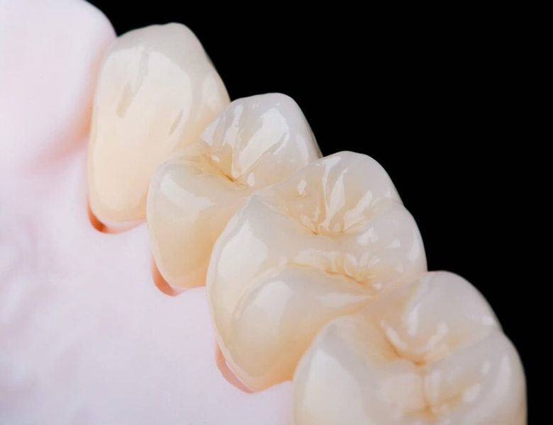 西馬込（大田区）の歯医者、なおい歯科クリニックのマイクロスコープ精密治療