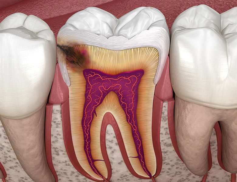 西馬込（大田区）の歯医者、なおい歯科クリニックのマイクロスコープ精密治療