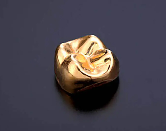 西馬込（大田区）の歯医者、なおい歯科クリニックの審美歯科治療