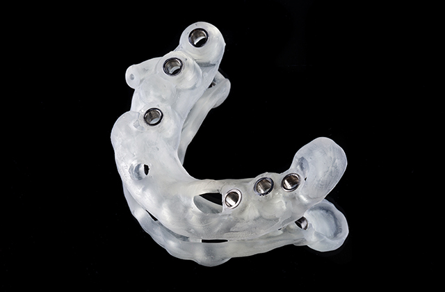 西馬込（大田区）の歯医者、なおい歯科クリニックのインプラント治療