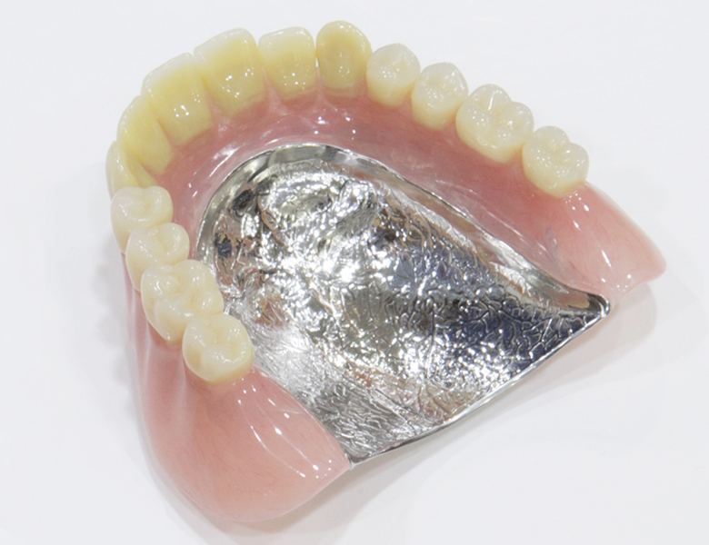 西馬込（大田区）の歯医者、なおい歯科クリニックの入れ歯治療