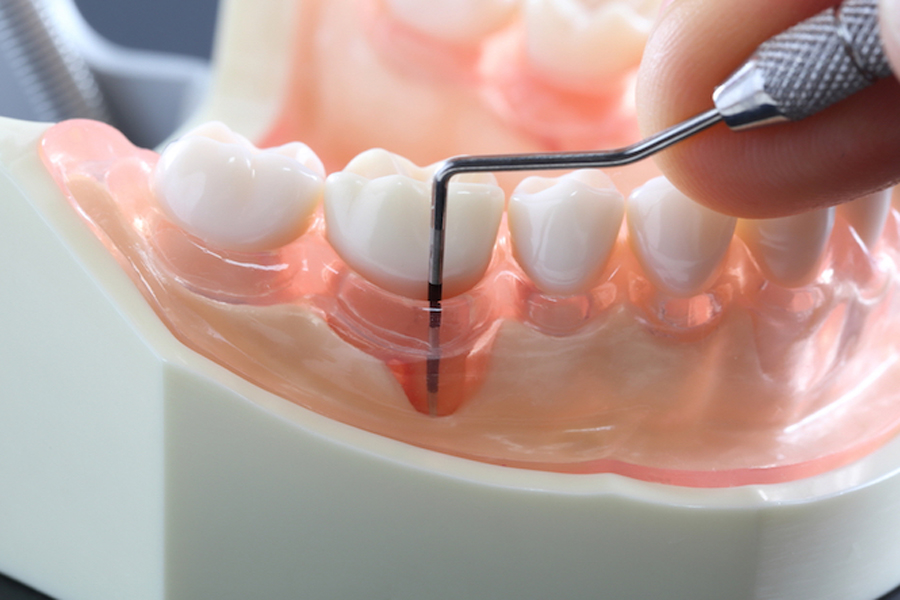 西馬込（大田区）の歯医者、なおい歯科クリニックの予防歯科