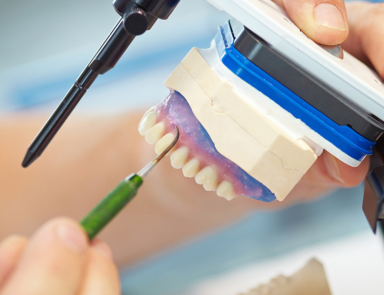 西馬込（大田区）の歯医者、なおい歯科クリニックの審美歯科治療