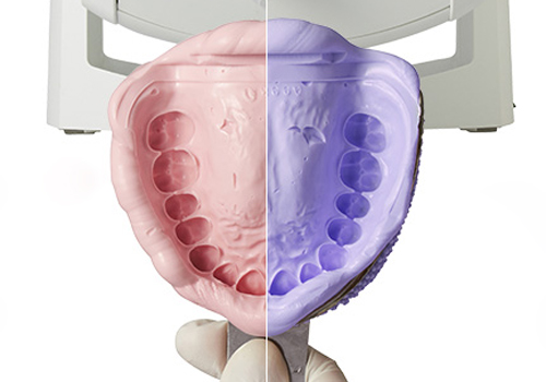 西馬込（大田区）の歯医者、なおい歯科クリニックの審美歯科治療