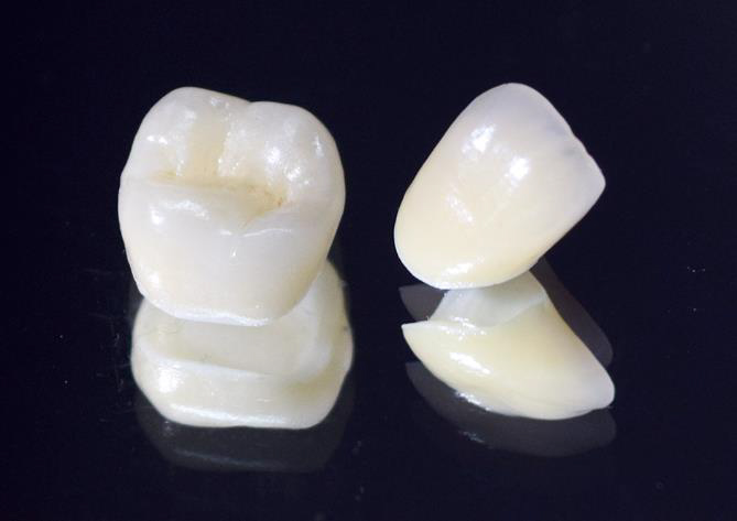 西馬込（大田区）の歯医者、なおい歯科クリニックの審美歯科治療